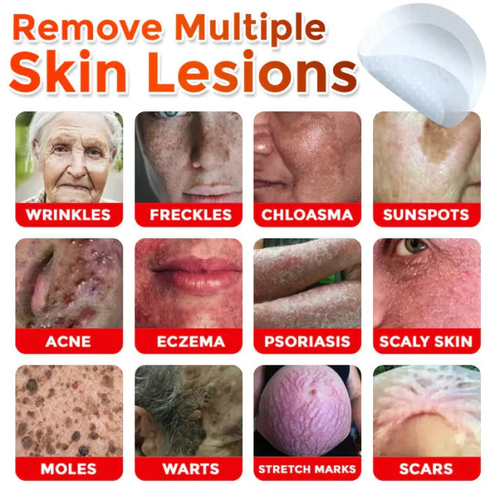 Painless Skin Tag & Wart Removal Patches