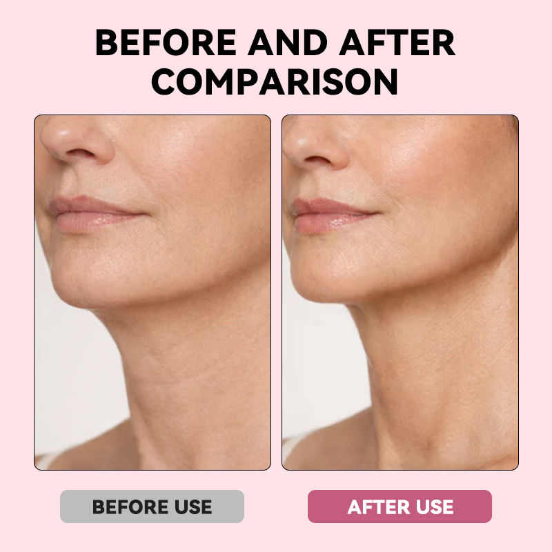 Ear-Hook Facial Contouring Mask