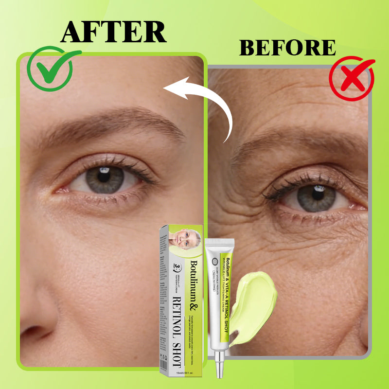 The Vita-A Retinol Precision Shot 🧪 — Advanced Lifting for Your Youthful Glow