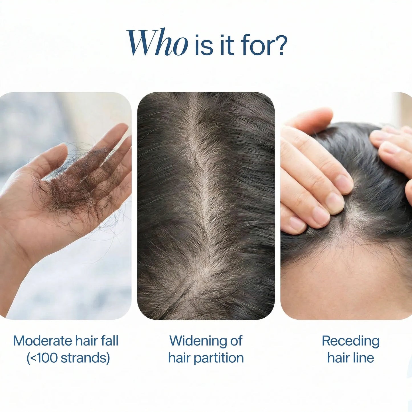 Bodywise Byvirexa Hair Growth  Roll on Serum