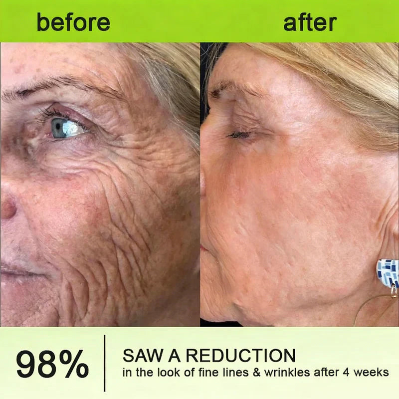 The Vita-A Retinol Precision Shot 🧪 — Advanced Lifting for Your Youthful Glow