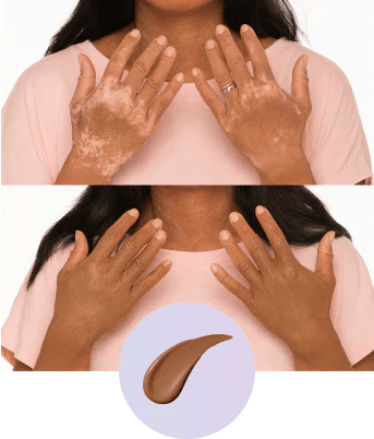 💜Last day: Buy one, get one free!💜✨Body Coverage Perfector – waterproof, lightweight and flawless body make-up