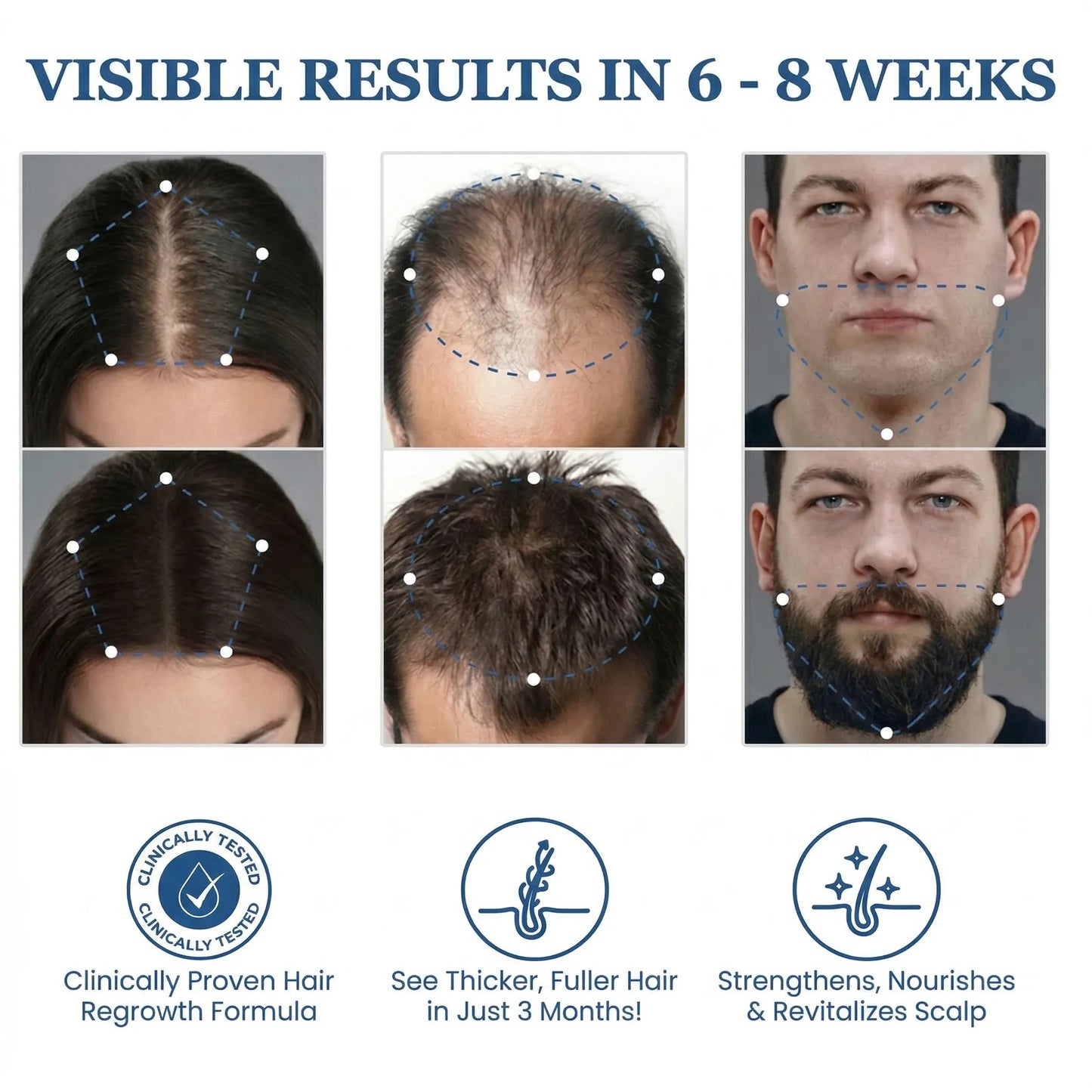 Bodywise Byvirexa Hair Growth  Roll on Serum