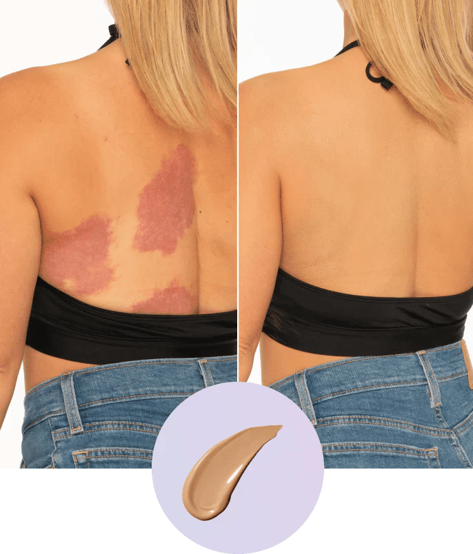 💜Last day: Buy one, get one free!💜✨Body Coverage Perfector – waterproof, lightweight and flawless body make-up